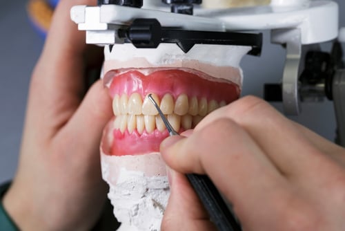 denture relines image